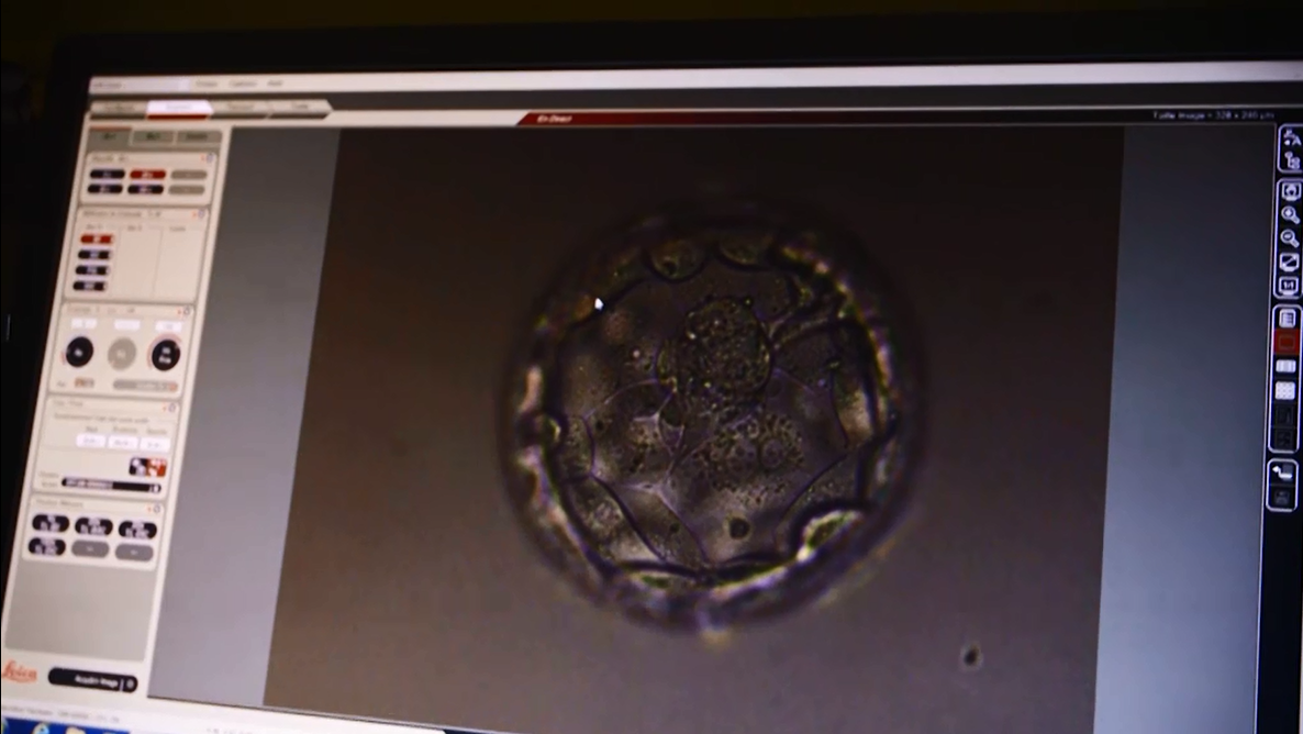 Blastocyste à J5 de culture embryonnaire