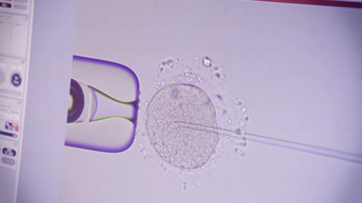 Fécondation in vitro ovule ponctionné