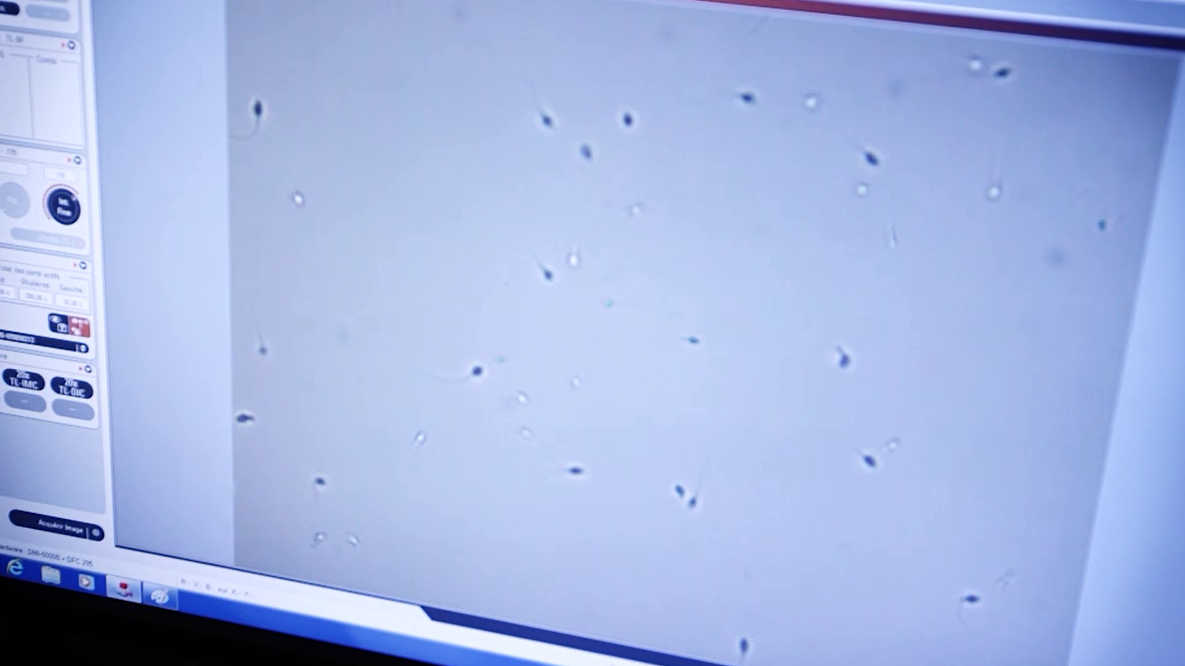 Gamètes Spermatozoides