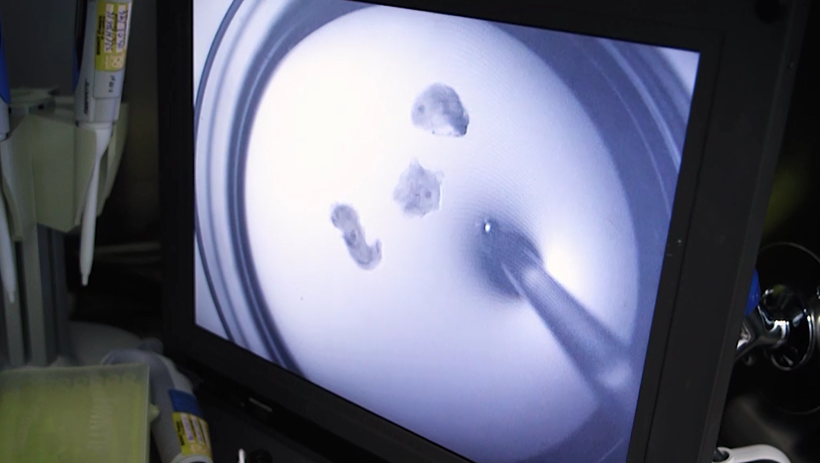 Recueil ovocytes sous microscope