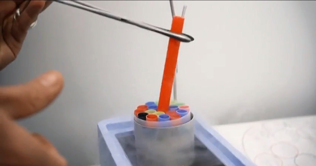 tube congelation